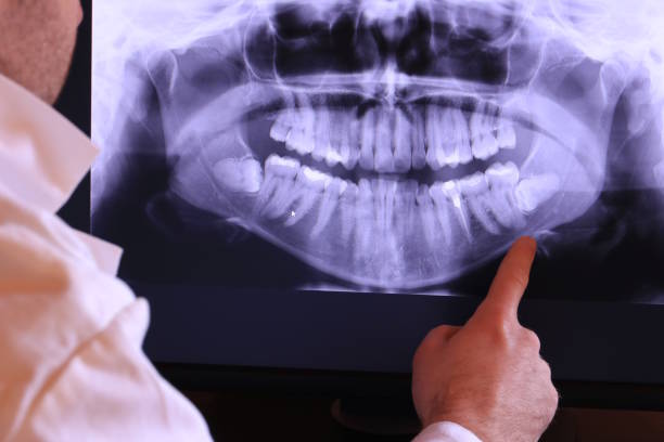 Best Emergency Root Canal Treatment in Dland, MI