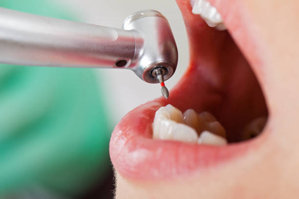 Best Emergency Dentist for Special Needs Patients in Dland, MI